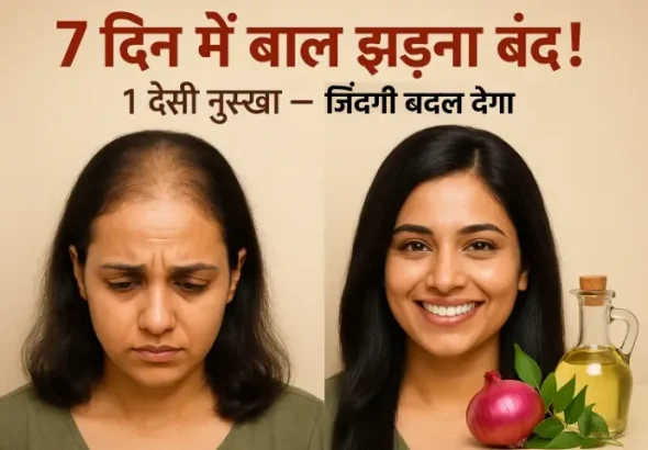 7 दिन में बाल झड़ना बंद! ये 1 घरेलू नुस्खा बदल देगा आपकी ज़िंदगी